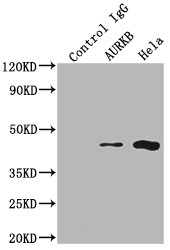 Immunoprecipitating AURKB in Hela whole cell lysate<br />
Lane 1: Rabbit control IgG instead of CSB-RA230110A0HU in Hela whole cell lysate.
For western blotting,a HRP-conjugated Protein G antibody was used as the secondary antibody (1/2000)<br />
Lane 2: CSB-RA230110A0HU(2µg)+ Hela whole cell lysate(500µg)<br />
Lane 3: Hela whole cell lysate (10µg)<br />