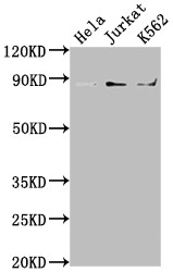 Western Blot<br />Positive WB detected in: Hela whole cell lysate, Jurkat whole cell lysate, K562 whole cell lysate<br />All lanes: IKBKB antibody at 1:2000<br />Secondary<br />Goat polyclonal to rabbit IgG at 1/50000 dilution<br />Predicted band size: 87, 86, 30, 80 kDa<br />Observed band size: 87 kDa<br />