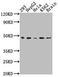 Western Blot<br />
Positive WB detected in: 293 whole cell lysate, HepG2 whole cell lysate, Hela whole cell lysate, K562 whole cell lysate, Rat brain tissue<br />
All lanes: FNTB antibody at 1:2000<br />
Secondary<br />
Goat polyclonal to rabbit IgG at 1/50000 dilution<br />
Predicted band size: 49, 44 kDa<br />
Observed band size: 49 kDa<br />