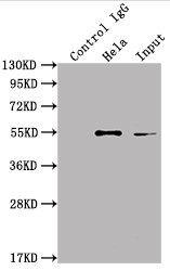 Immunoprecipitating ILK in Hela whole cell lysate<br />
Lane 1: Rabbit control IgG instead of CSB-RA963626A0HU in Hela whole cell lysate.
For western blotting,a HRP-conjugated Protein G antibody was used as the secondary antibody (1/2000)<br />
Lane 2: CSB-RA963626A0HU(2µg)+ Hela whole cell lysate(500µg)<br />
Lane 3: Hela whole cell lysate (10µg)<br />