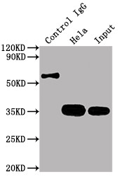 Immunoprecipitating CDK4 in Hela whole cell lysate<br />Lane 1: Rabbit control IgG instead of CSB-RA965615A0HU in Hela whole cell lysate.For western blotting,a HRP-conjugated Protein G antibody was used as the secondary antibody (1/1500)<br />Lane 2:CSB-RA965615A0HU(2µg)+ Hela whole cell lysate(500µg)<br />Lane 3: Hela whole cell lysate (10µg)<br />
