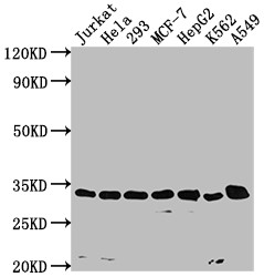 Western Blot<br />Positive WB detected in: Jurkat whole cell lysate, Hela whole cell lysate, 293 whole cell lysate, MCF-7 whole cell lysate, HepG2 whole cell lysate, K562 whole cell lysate, A549 whole cell lysate<br />All lanes: CDK4 antibody at 1:1500<br />Secondary<br />Goat polyclonal to rabbit IgG at 1/50000 dilution<br />Predicted band size: 34, 21 kDa<br />Observed band size: 34 kDa<br />