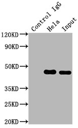 Immunoprecipitating MAP2K1 in Hela whole cell lysate<br />Lane 1: Rabbit control IgG instead of CSB-RA957619A0HU in Hela whole cell lysate.For western blotting,a HRP-conjugated Protein G antibody was used as the secondary antibody (1/2000)<br />Lane 2: CSB-RA957619A0HU(2µg)+ Hela whole cell lysate(500µg)<br />Lane 3: Hela whole cell lysate (10µg)<br />