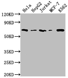 Western Blot<br />Positive WB detected in: Hela whole cell lysate, HepG2 whole cell lysate, Jurkat whole cell lysate, MCF-7 whole cell lysate, K562 whole cell lysate<br />All lanes: HDAC2 antibody at 1:2000<br />Secondary<br />Goat polyclonal to rabbit IgG at 1/50000 dilution<br />Predicted band size: 56, 52 kDa<br />Observed band size: 60 kDa<br />