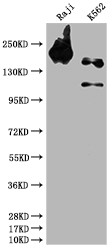 Western Blot<br />Positive WB detected in: Raji whole cell lysate, K562 whole cell lysate<br />All lanes: INPP5D antibody at 1:1500<br />Secondary<br />Goat polyclonal to rabbit IgG at 1/50000 dilution<br />Predicted band size: 134, 110 kDa<br />Observed band size: 145 kDa<br />