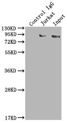 Immunoprecipitating SUZ12 in K562 whole cell lysate<br />Lane 1: Rabbit control IgG instead of CSB-RA159561A0HU in K562 whole cell lysate.For western blotting,a HRP-conjugated Protein G antibody was used as the secondary antibody (1/2000)<br />Lane 2: CSB-RA159561A0HU(2µg)+ K562 whole cell lysate(500µg)<br />Lane 3: K562 whole cell lysate (10µg)<br />