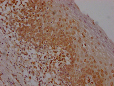 IHC image of CSB-RA826096A0HU diluted at 1:100 and staining in paraffin-embedded human tonsil tissue performed on a Leica BondTM system. After dewaxing and hydration, antigen retrieval was mediated by high pressure in a citrate buffer (pH 6.0). Section was blocked with 10% normal goat serum 30min at RT. Then primary antibody (1% BSA) was incubated at 4℃ overnight. The primary is detected by a Goat anti-rabbit IgG polymer labeled by HRP and visualized using 0.05% DAB.