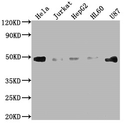 Western Blot<br />
Positive WB detected in: Hela whole cell lysate, Jurkat whole cell lysate, HepG2 whole cell lysate, HL60 whole cell lysate, U87 whole cell lysate<br />
All lanes: FAS antibody at 1:2000<br />
Secondary<br />
Goat polyclonal to rabbit IgG at 1/50000 dilution<br />
Predicted band size: 38, 12, 10, 17, 15, 36, 25 kDa<br />
Observed band size: 45 kDa<br />