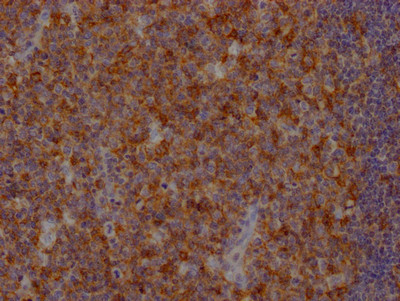 IHC image of CSB-RA252392A0HU diluted at 1:100 and staining in paraffin-embedded human tonsil tissue performed on a Leica BondTM system. After dewaxing and hydration, antigen retrieval was mediated by high pressure in a citrate buffer (pH 6.0). Section was blocked with 10% normal goat serum 30min at RT. Then primary antibody (1% BSA) was incubated at 4℃ overnight. The primary is detected by a Goat anti-rabbit IgG polymer labeled by HRP and visualized using 0.05% DAB.