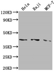 Western Blot<br />
Positive WB detected in: Hela whole cell lysate, Raji whole cell lysate, MCF-7 whole cell lysate<br />
All lanes: AGTR1 antibody at 1:2000<br />
Secondary<br />
Goat polyclonal to rabbit IgG at 1/50000 dilution<br />
Predicted band size: 42 kDa<br />
Observed band size: 42 kDa<br />