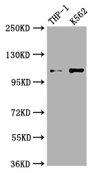 Western Blot<br />
Positive WB detected in: THP-1 whole cell lysate, K562 whole cell lysate<br />
All lanes: C3 antibody at 1:1000<br />
Secondary<br />
Goat polyclonal to rabbit IgG at 1/50000 dilution<br />
Predicted band size: 188 kDa<br />
Observed band size: 115 kDa<br />