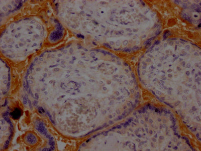 IHC image of CSB-RA224179A0HU diluted at 1:100 and staining in paraffin-embedded human placenta tissue performed on a Leica BondTM system. After dewaxing and hydration, antigen retrieval was mediated by high pressure in a citrate buffer (pH 6.0). Section was blocked with 10% normal goat serum 30min at RT. Then primary antibody (1% BSA) was incubated at 4℃ overnight. The primary is detected by a Goat anti-rabbit IgG polymer labeled by HRP and visualized using 0.05% DAB.