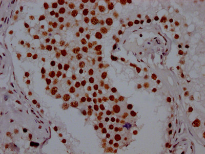 IHC image of CSB-RA569290A0HU diluted at 1:100 and staining in paraffin-embedded human testis tissue performed on a Leica BondTM system. After dewaxing and hydration, antigen retrieval was mediated by high pressure in a citrate buffer (pH 6.0). Section was blocked with 10% normal goat serum 30min at RT. Then primary antibody (1% BSA) was incubated at 4℃ overnight. The primary is detected by a Goat anti-rabbit IgG polymer labeled by HRP and visualized using 0.05% DAB.