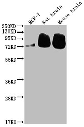 Western Blot<br />
Positive WB detected in: MCF-7 whole cell lysate, Rat brain tissue, Mouse brain tissue<br />
All lanes: BACE1 antibody at 1:2000<br />
Secondary<br />
Goat polyclonal to rabbit IgG at 1/50000 dilution<br />
Predicted band size: 56, 53, 52, 49, 46, 43 kDa<br />
Observed band size: 72 kDa<br />