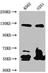 Western Blot<br />
Positive WB detected in: K562 whole cell lysate, U-251 whole cell lysate<br />
All lanes: BubR1 antibody at 1:1000<br />
Secondary<br />
Goat polyclonal to rabbit IgG at 1/50000 dilution<br />
Predicted band size: 120, 106, 122 kDa<br />
Observed band size: 125 kDa<br />