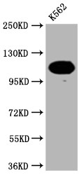 Western Blot<br />
Positive WB detected in: K562 whole cell lysate<br />
All lanes: PARP antibody at 1:2000<br />
Secondary<br />
Goat polyclonal to rabbit IgG at 1/50000 dilution<br />
Predicted band size: 114 KDa<br />
Observed band size: 114 kDa<br />