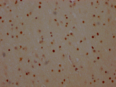 IHC image of CSB-RA581794A0HU diluted at 1:100 and staining in paraffin-embedded human brain tissue performed on a Leica BondTM system. After dewaxing and hydration, antigen retrieval was mediated by high pressure in a citrate buffer (pH 6.0). Section was blocked with 10% normal goat serum 30min at RT. Then primary antibody (1% BSA) was incubated at 4℃ overnight. The primary is detected by a Goat anti-rabbit IgG polymer labeled by HRP and visualized using 0.05% DAB.