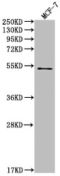 Western Blot<br />
Positive WB detected in: MCF-7 whole cell lysate<br />
All lanes: PD1 antibody at 1:2000<br />
Secondary<br />
Goat polyclonal to rabbit IgG at 1/50000 dilution<br />
Predicted band size: 32 KDa<br />
Observed band size: 32 kDa<br />