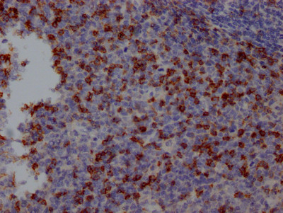 IHC image of CSB-RA240597A0HU diluted at 1:100 and staining in paraffin-embedded human tonsil tissue performed on a Leica BondTM system. After dewaxing and hydration, antigen retrieval was mediated by high pressure in a citrate buffer (pH 6.0). Section was blocked with 10% normal goat serum 30min at RT. Then primary antibody (1% BSA) was incubated at 4℃ overnight. The primary is detected by a Goat anti-rabbit IgG polymer labeled by HRP and visualized using 0.05% DAB.