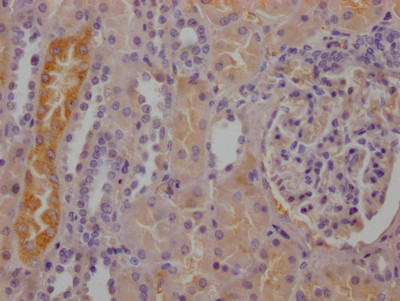 IHC image of CSB-RA784971A0HU diluted at 1:100 and staining in paraffin-embedded human kidney tissue performed on a Leica BondTM system. After dewaxing and hydration, antigen retrieval was mediated by high pressure in a citrate buffer (pH 6.0). Section was blocked with 10% normal goat serum 30min at RT. Then primary antibody (1% BSA) was incubated at 4℃ overnight. The primary is detected by a Goat anti-rabbit IgG polymer labeled by HRP and visualized using 0.05% DAB.