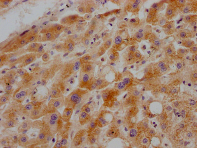 IHC image of CSB-RA978909A0HU diluted at 1:100 and staining in paraffin-embedded human liver tissue performed on a Leica BondTM system. After dewaxing and hydration, antigen retrieval was mediated by high pressure in a citrate buffer (pH 6.0). Section was blocked with 10% normal goat serum 30min at RT. Then primary antibody (1% BSA) was incubated at 4℃ overnight. The primary is detected by a Goat anti-rabbit IgG polymer labeled by HRP and visualized using 0.05% DAB.