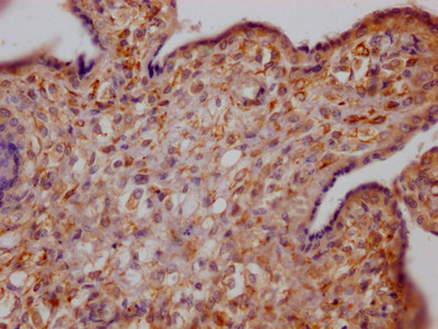 IHC image of CSB-RA978909A0HU diluted at 1:100 and staining in paraffin-embedded human placenta tissue performed on a Leica BondTM system. After dewaxing and hydration, antigen retrieval was mediated by high pressure in a citrate buffer (pH 6.0). Section was blocked with 10% normal goat serum 30min at RT. Then primary antibody (1% BSA) was incubated at 4℃ overnight. The primary is detected by a Goat anti-rabbit IgG polymer labeled by HRP and visualized using 0.05% DAB.