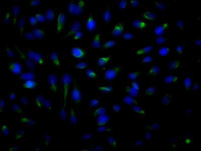 Immunofluorescence staining of Hela Cells with CSB-RA152329A0HU at 1:50, counter-stained with DAPI. The cells were fixed in 4% formaldehyde, permeated by 0.2% TritonX-100, and blocked in 10% normal Goat Serum. The cells were then incubated with the antibody overnight at 4℃. Nuclear DNA was labeled in blue with DAPI. The secondary antibody was FITC-conjugated AffiniPure Goat Anti-Rabbit IgG (H+L).