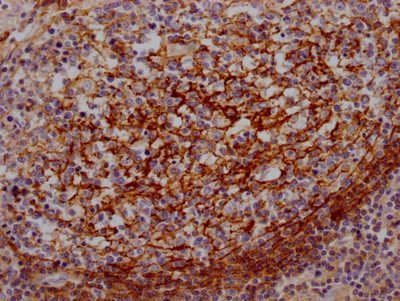 IHC image of CSB-RA440943A0HU diluted at 1:100 and staining in paraffin-embedded human lung tissue performed on a Leica BondTM system. After dewaxing and hydration, antigen retrieval was mediated by high pressure in a citrate buffer (pH 6.0). Section was blocked with 10% normal goat serum 30min at RT. Then primary antibody (1% BSA) was incubated at 4℃ overnight. The primary is detected by a Goat anti-rabbit IgG polymer labeled by HRP and visualized using 0.05% DAB.