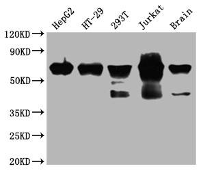 Western Blot<br />Positive WB detected in: HepG2 whole cell lysate, HT-29 whole cell lysate, 293T whole cell lysate, Jurkat whole cell lysate, Mouse brain tissue<br />All lanes: DDX5 antibody at 1:2000<br />Secondary<br />Goat polyclonal to rabbit IgG at 1/50000 dilution<br />Predicted band size: 70, 61 kDa<br />Observed band size: 70 kDa<br />