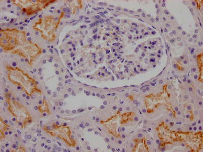 IHC image of CSB-RA268157A0HU diluted at 1:100 and staining in paraffin-embedded human kidney tissue performed on a Leica BondTM system. After dewaxing and hydration, antigen retrieval was mediated by high pressure in a citrate buffer (pH 6.0). Section was blocked with 10% normal goat serum 30min at RT. Then primary antibody (1% BSA) was incubated at 4℃ overnight. The primary is detected by a Goat anti-rabbit IgG polymer labeled by HRP and visualized using 0.05% DAB.