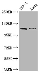 Western Blot<br />
Positive WB detected in: THP-1 whole cell lysate, Mouse lung tissue<br />
All lanes: MDA5 antibody at 1:2000<br />
Secondary<br />
Goat polyclonal to rabbit IgG at 1/50000 dilution<br />
Predicted band size: 117, 26 kDa<br />
Observed band size: 117 kDa<br />