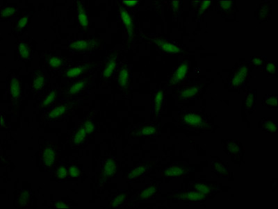 Immunofluorescence staining of Hela Cells with CSB-RA287160A0HU at 1:50, counter-stained with DAPI. The cells were fixed in 4% formaldehyde, permeated by 0.2% TritonX-100, and blocked in 10% normal Goat Serum. The cells were then incubated with the antibody overnight at 4℃. Nuclear DNA was labeled in blue with DAPI. The secondary antibody was FITC-conjugated AffiniPure Goat Anti-Rabbit IgG (H+L).