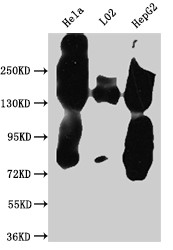 Western Blot<br />
Positive WB detected in: Hela whole cell lysate, L02 whole cell lysate, HepG2 whole cell lysate<br />
All lanes: EGFR antibody at 1:1000<br />
Secondary<br />
Goat polyclonal to rabbit IgG at 1/50000 dilution<br />
Predicted band size: 135, 45, 78, 70 kDa<br />
Observed band size: 150 kDa<br />