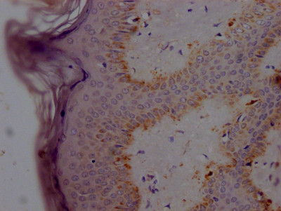 IHC image of CSB-RA585595A0HU diluted at 1:100 and staining in paraffin-embedded human skin tissue performed on a Leica BondTM system. After dewaxing and hydration, antigen retrieval was mediated by high pressure in a citrate buffer (pH 6.0). Section was blocked with 10% normal goat serum 30min at RT. Then primary antibody (1% BSA) was incubated at 4℃ overnight. The primary is detected by a Goat anti-rabbit IgG polymer labeled by HRP and visualized using 0.05% DAB.