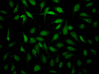 Immunofluorescence staining of Hela Cells with CSB-RA260392A0HU at 1:50, counter-stained with DAPI. The cells were fixed in 4% formaldehyde, permeated by 0.2% TritonX-100, and blocked in 10% normal Goat Serum. The cells were then incubated with the antibody overnight at 4℃. Nuclear DNA was labeled in blue with DAPI. The secondary antibody was FITC-conjugated AffiniPure Goat Anti-Rabbit IgG (H+L).