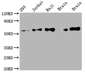 Western Blot<br />Positive WB detected in: 293 whole cell lysate, Jurkat whole cell lysate, Raji whole cell lysate, Mouse brain tissue, Rat brain tissue<br />All lanes: PAK2 antibody at 1:2000<br />Secondary<br />Goat polyclonal to rabbit IgG at 1/50000 dilution<br />Predicted band size: 59 kDa<br />Observed band size: 59 kDa<br />