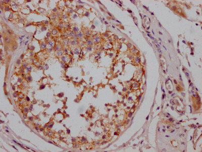 IHC image of CSB-RA171021A0HU diluted at 1:100 and staining in paraffin-embedded human testis tissue performed on a Leica BondTM system. After dewaxing and hydration, antigen retrieval was mediated by high pressure in a citrate buffer (pH 6.0). Section was blocked with 10% normal goat serum 30min at RT. Then primary antibody (1% BSA) was incubated at 4℃ overnight. The primary is detected by a Goat anti-rabbit IgG polymer labeled by HRP and visualized using 0.05% DAB.