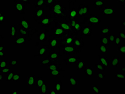Immunofluorescence staining of Hela Cells with CSB-RA571479A0HU at 1:50, counter-stained with DAPI. The cells were fixed in 4% formaldehyde, permeated by 0.2% TritonX-100, and blocked in 10% normal Goat Serum. The cells were then incubated with the antibody overnight at 4℃. Nuclear DNA was labeled in blue with DAPI. The secondary antibody was FITC-conjugated AffiniPure Goat Anti-Rabbit IgG (H+L).
