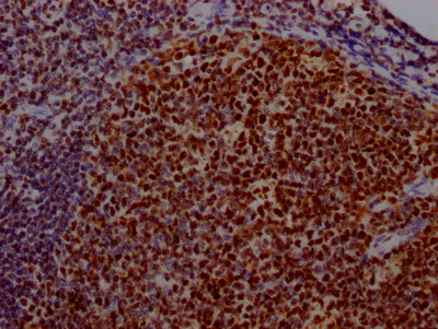 IHC image of CSB-RA192026A0HU diluted at 1:100 and staining in paraffin-embedded human tonsil tissue performed on a Leica BondTM system. After dewaxing and hydration, antigen retrieval was mediated by high pressure in a citrate buffer (pH 6.0). Section was blocked with 10% normal goat serum 30min at RT. Then primary antibody (1% BSA) was incubated at 4℃ overnight. The primary is detected by a Goat anti-rabbit IgG polymer labeled by HRP and visualized using 0.05% DAB.