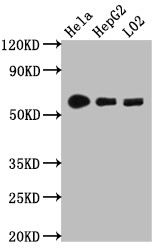 Western Blot<br />Positive WB detected in: Hela whole cell lysate, HepG2 whole cell lysate, L02 whole cell lysate<br />All lanes: CYP1A2 antibody at 1:1000<br />Secondary<br />Goat polyclonal to rabbit IgG at 1/50000 dilution<br />Predicted band size: 59 kDa<br />Observed band size: 59 kDa<br />