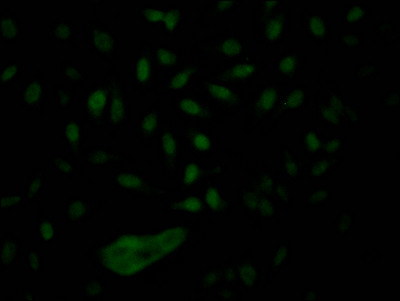 Immunofluorescence staining of Hela Cells with CSB-RA986790A0HU at 1:50, counter-stained with DAPI. The cells were fixed in 4% formaldehyde, permeated by 0.2% TritonX-100, and blocked in 10% normal Goat Serum. The cells were then incubated with the antibody overnight at 4℃. Nuclear DNA was labeled in blue with DAPI. The secondary antibody was FITC-conjugated AffiniPure Goat Anti-Rabbit IgG (H+L).