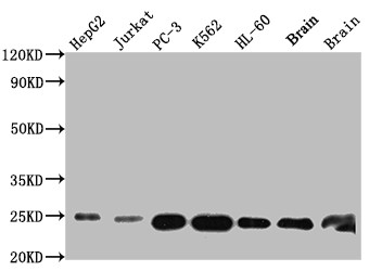 Western Blot<br />
Positive WB detected in: HepG2 whole cell lysate, Jurkat whole cell lysate, PC-3 whole cell lysate, K562 whole cell lysate, HL-60 whole cell lysate, Mouse Brain whole cell lysate, Rat Brain whole cell lysate<br />
All lanes: GSTP1 antibody at 1:1000<br />
Secondary<br />
Goat polyclonal to rabbit IgG at 1/50000 dilution<br />
Predicted band size: 24 kDa<br />
Observed band size: 24 kDa<br />