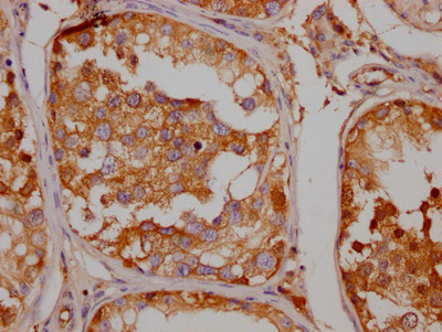 IHC image of CSB-RA224413A0HU diluted at 1:100 and staining in paraffin-embedded human testis tissue performed on a Leica BondTM system. After dewaxing and hydration, antigen retrieval was mediated by high pressure in a citrate buffer (pH 6.0). Section was blocked with 10% normal goat serum 30min at RT. Then primary antibody (1% BSA) was incubated at 4℃ overnight. The primary is detected by a Goat anti-rabbit IgG polymer labeled by HRP and visualized using 0.05% DAB.