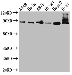 Western Blot<br />
Positive WB detected in: A549 whole cell lysate, Hela whole cell lysate, A375 whole cell lysate, HT-29 whole cell lysate, HepG2 whole cell lysate, U-87 whole cell lysate<br />
All lanes: Furin antibody at 1:1000<br />
Secondary<br />
Goat polyclonal to rabbit IgG at 1/50000 dilution<br />
Predicted band size: 87 kDa<br />
Observed band size: 87, 72 kDa<br />