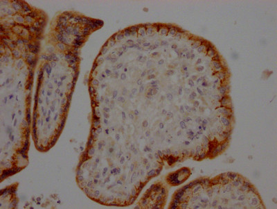 IHC image of CSB-RA271669A0HU diluted at 1:100 and staining in paraffin-embedded human placenta tissue performed on a Leica BondTM system. After dewaxing and hydration, antigen retrieval was mediated by high pressure in a citrate buffer (pH 6.0). Section was blocked with 10% normal goat serum 30min at RT. Then primary antibody (1% BSA) was incubated at 4℃ overnight. The primary is detected by a Goat anti-rabbit IgG polymer labeled by HRP and visualized using 0.05% DAB.