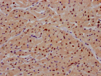 IHC image of CSB-RA236860A0HU diluted at 1:100 and staining in paraffin-embedded human heart tissue performed on a Leica BondTM system. After dewaxing and hydration, antigen retrieval was mediated by high pressure in a citrate buffer (pH 6.0). Section was blocked with 10% normal goat serum 30min at RT. Then primary antibody (1% BSA) was incubated at 4℃ overnight. The primary is detected by a Goat anti-rabbit IgG polymer labeled by HRP and visualized using 0.05% DAB.