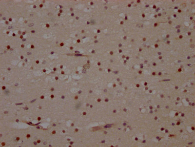 IHC image of CSB-RA236860A0HU diluted at 1:100 and staining in paraffin-embedded human brain tissue performed on a Leica BondTM system. After dewaxing and hydration, antigen retrieval was mediated by high pressure in a citrate buffer (pH 6.0). Section was blocked with 10% normal goat serum 30min at RT. Then primary antibody (1% BSA) was incubated at 4℃ overnight. The primary is detected by a Goat anti-rabbit IgG polymer labeled by HRP and visualized using 0.05% DAB.