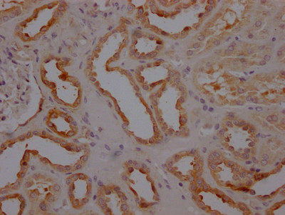 IHC image of CSB-RA241798A0HU diluted at 1:100 and staining in paraffin-embedded human kidney tissue performed on a Leica BondTM system. After dewaxing and hydration, antigen retrieval was mediated by high pressure in a citrate buffer (pH 6.0). Section was blocked with 10% normal goat serum 30min at RT. Then primary antibody (1% BSA) was incubated at 4℃ overnight. The primary is detected by a Goat anti-rabbit IgG polymer labeled by HRP and visualized using 0.05% DAB.