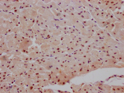 IHC image of CSB-RA990134A0HU diluted at 1:100 and staining in paraffin-embedded human heart tissue performed on a Leica BondTM system. After dewaxing and hydration, antigen retrieval was mediated by high pressure in a citrate buffer (pH 6.0). Section was blocked with 10% normal goat serum 30min at RT. Then primary antibody (1% BSA) was incubated at 4℃ overnight. The primary is detected by a Goat anti-rabbit IgG polymer labeled by HRP and visualized using 0.05% DAB.