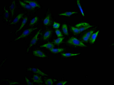 Immunofluorescence staining of Hela Cells with CSB-RA554990A0HU at 1:50, counter-stained with DAPI. The cells were fixed in 4% formaldehyde, permeated by 0.2% TritonX-100, and blocked in 10% normal Goat Serum. The cells were then incubated with the antibody overnight at 4℃. Nuclear DNA was labeled in blue with DAPI. The secondary antibody was FITC-conjugated AffiniPure Goat Anti-Rabbit IgG (H+L).